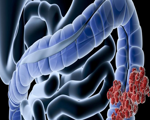 Digestive Tract - Macs Clinic